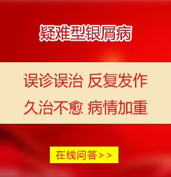 阜阳银屑病疾病问答