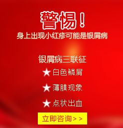 阜阳银屑病医院