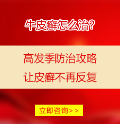 阜阳银屑病医院资讯