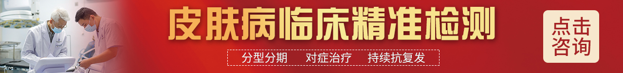 阜阳银屑病医院在线问诊